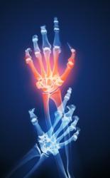 painful joints and inflammation